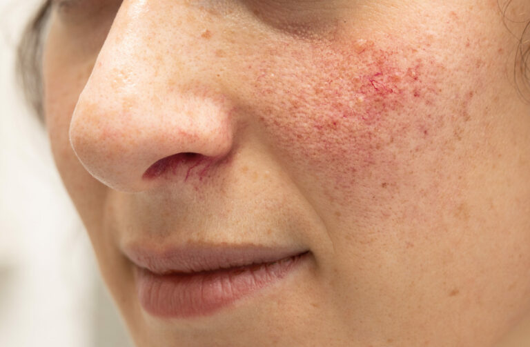 A,Closeup,View,On,The,Face,Of,A,Young,Woman