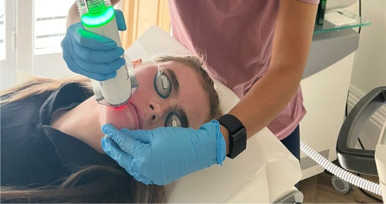 laser resurfacing london