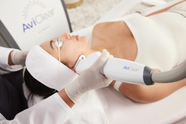 AviClear Treatment 1
