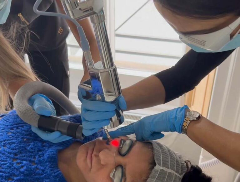 acne laser london