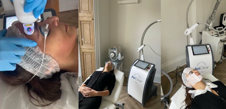 aviclear harley street london