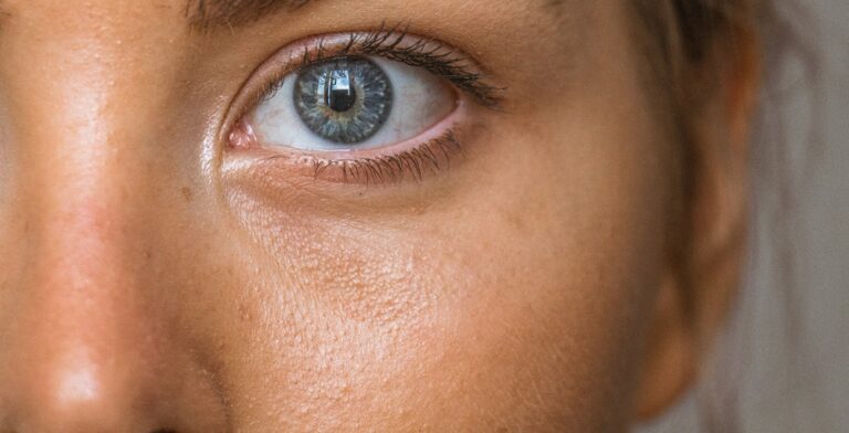 sensitive skin