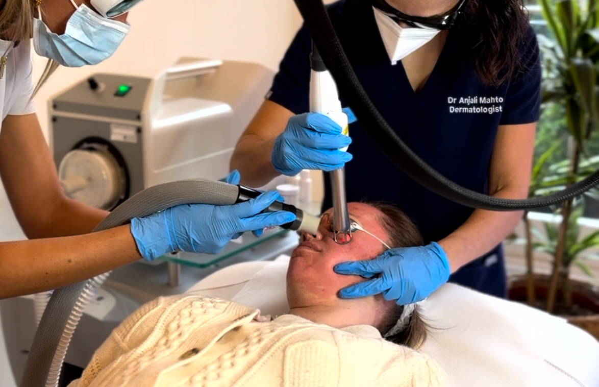Reveal Radiant Skin with 3DMIRACL™ Laser Treatment