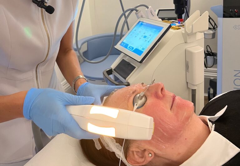 laser treatments 1