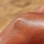 Can Sun Damage Really Be Reversed?