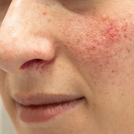A,Closeup,View,On,The,Face,Of,A,Young,Woman