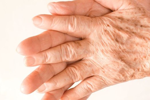 skin damage repair treatment harley street treatment for sun damaged skin on face harley street